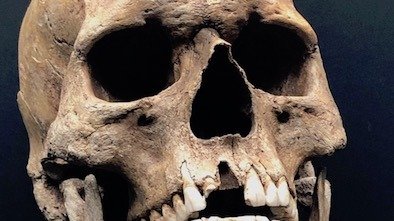Explore the Macabre at the Potteries Museum & Art Gallery potteries museum skull